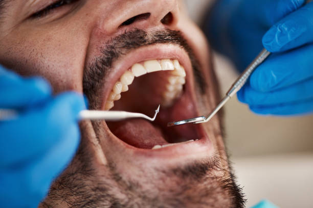 Best Emergency Broken Tooth Repair in Mount Pleasant, UT
